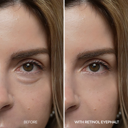 Dr. Melaxin Eyephalt Retinal Eyebag Cream