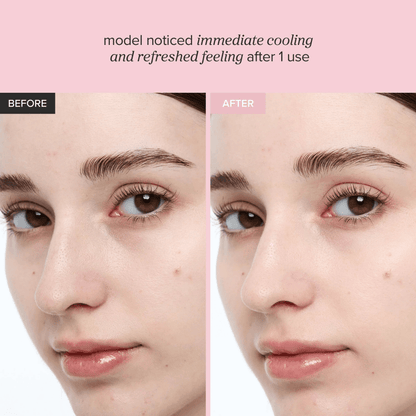 Before and after images showing the effects of Beauty of Joseon Red Bean Refreshing Pore Mask on model's skin.