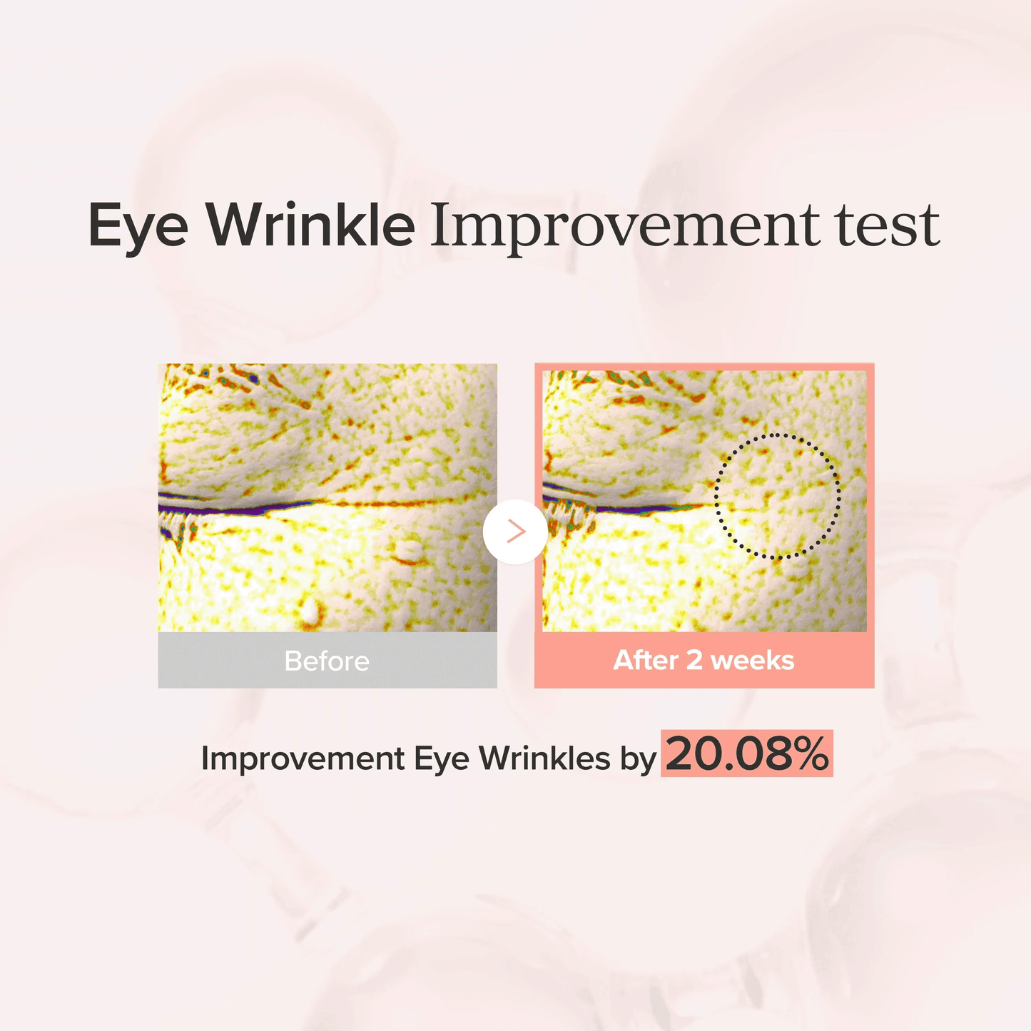 Eye Wrinkle Improvement test showing results before and after using Beauty of Joseon Revive Eye Serum Ginseng Retinal.