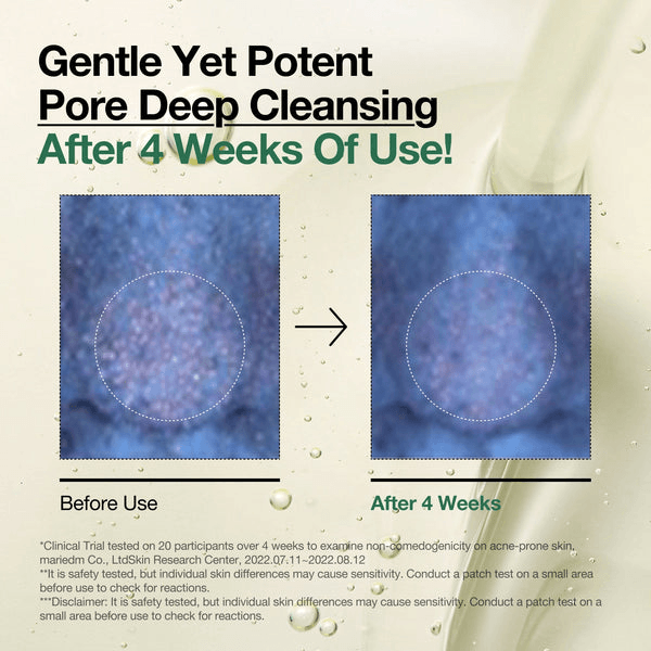 Before and after image showing pore deep cleansing results after 4 weeks of using Anua Heartleaf Pore Control Cleansing Oil.