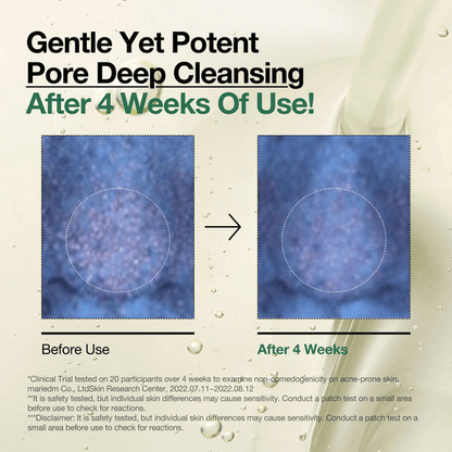 Before and after image showing pore deep cleansing results after 4 weeks of using Anua Heartleaf Pore Control Cleansing Oil.