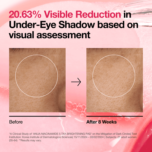 Before and after results showing 20.63% visible reduction in under-eye shadow with Anua Niacinamide 5 TXA Brightening Pad.