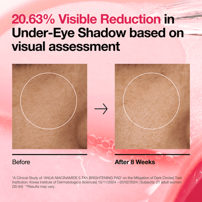 Before and after results showing 20.63% visible reduction in under-eye shadow with Anua Niacinamide 5 TXA Brightening Pad.