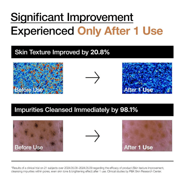 Before and after results images showcasing significant improvement in skin texture and impurities after using Anua Rice Enzyme Brightening Cleansing Powder.