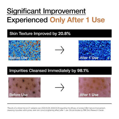 Before and after results images showcasing significant improvement in skin texture and impurities after using Anua Rice Enzyme Brightening Cleansing Powder.