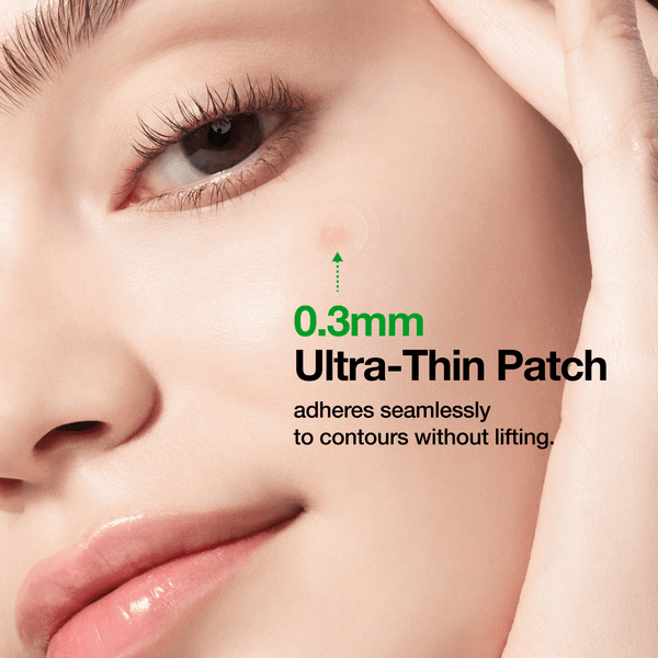 Anua Triple Acid Spot Care Microdart Patch shown on skin, demonstrating its 0.3mm ultra-thin design that adheres without lifting.