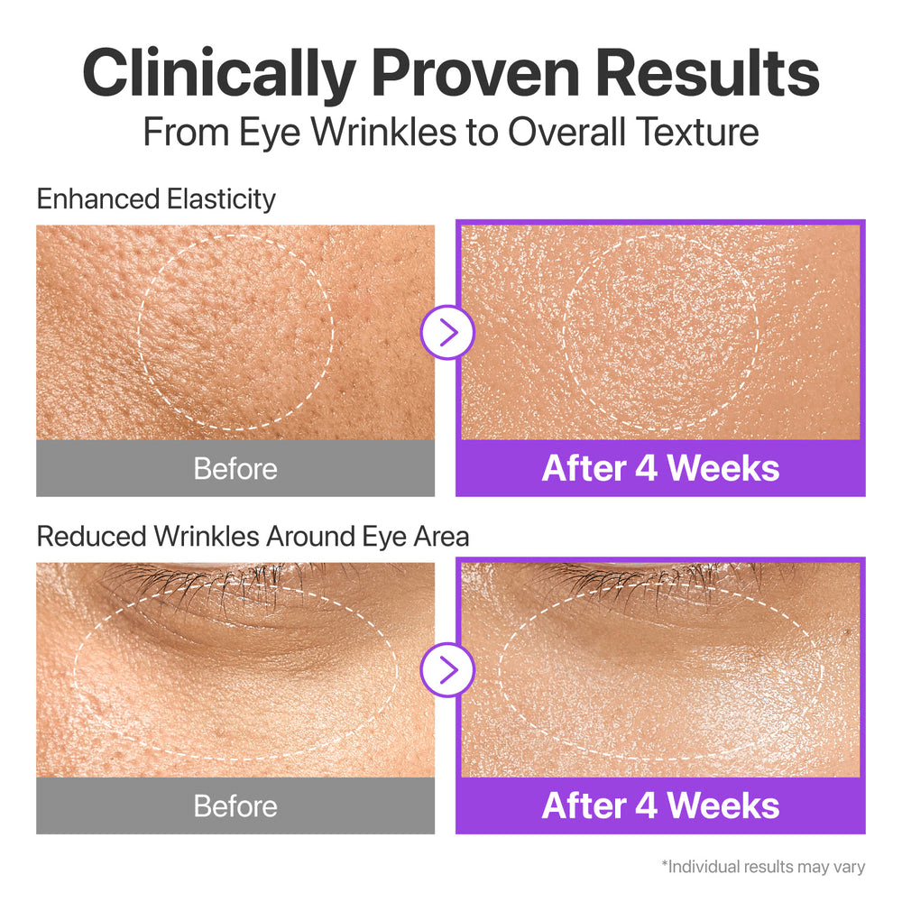 Clinically proven results of Numbuzin No. 9 NAD+ BIO Lifting-sil Essence showing enhanced elasticity and reduced eye wrinkles.