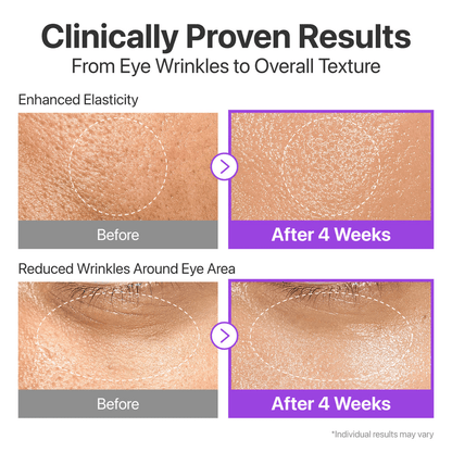 Clinically proven results of Numbuzin No. 9 NAD+ BIO Lifting-sil Essence showing enhanced elasticity and reduced eye wrinkles.