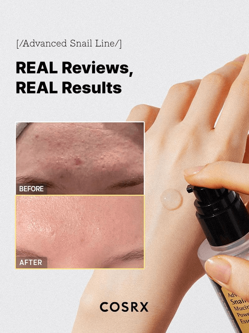 Before and after results of COSRX Advanced Snail 96 Mucin Power Essence showing improved skin texture.