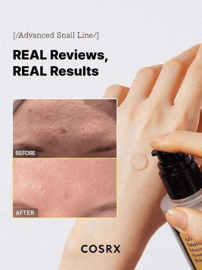 Before and after results of COSRX Advanced Snail 96 Mucin Power Essence showing improved skin texture.