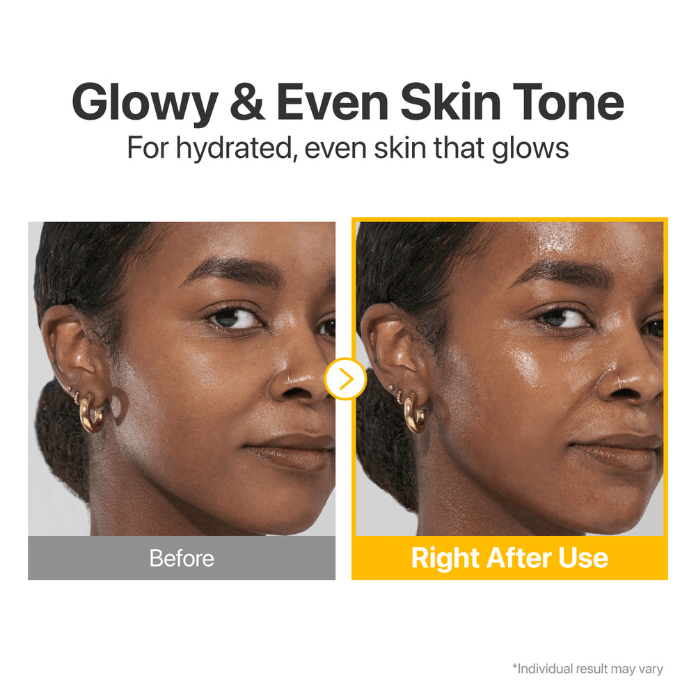 Before and after comparison showing glowy and even skin tone using numbuzin No.5 Glutathione Vitamin Concentrated Serum.