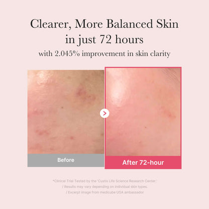 Before and after results showing clearer skin in 72 hours with Medicube TXA Niacinamide Serum for improved skin clarity.