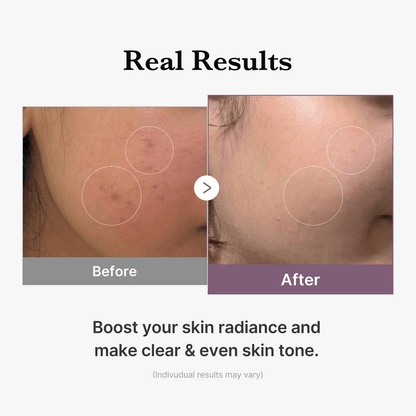Before and after results showing improved skin tone with Medicube AGE-R Glutathione Glow Milk Toner.