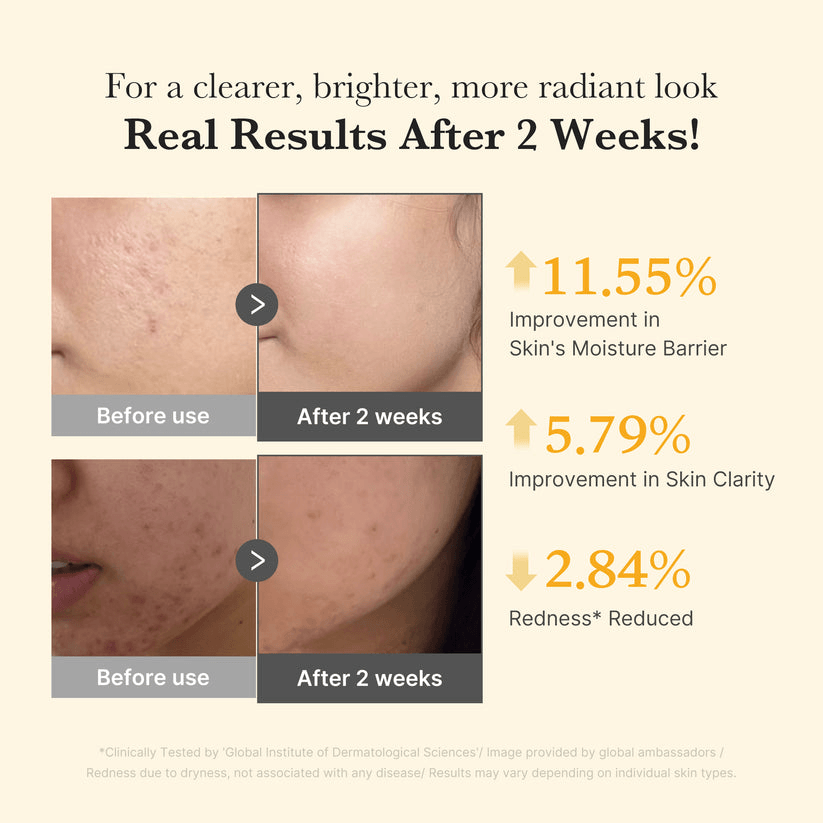Before and after results showcasing improvements in skin moisture, clarity, and reduced redness after using Medicube Kojic Acid Turmeric Capsule Serum.