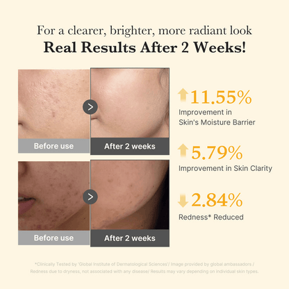 Before and after results showcasing improvements in skin moisture, clarity, and reduced redness after using Medicube Kojic Acid Turmeric Capsule Serum.