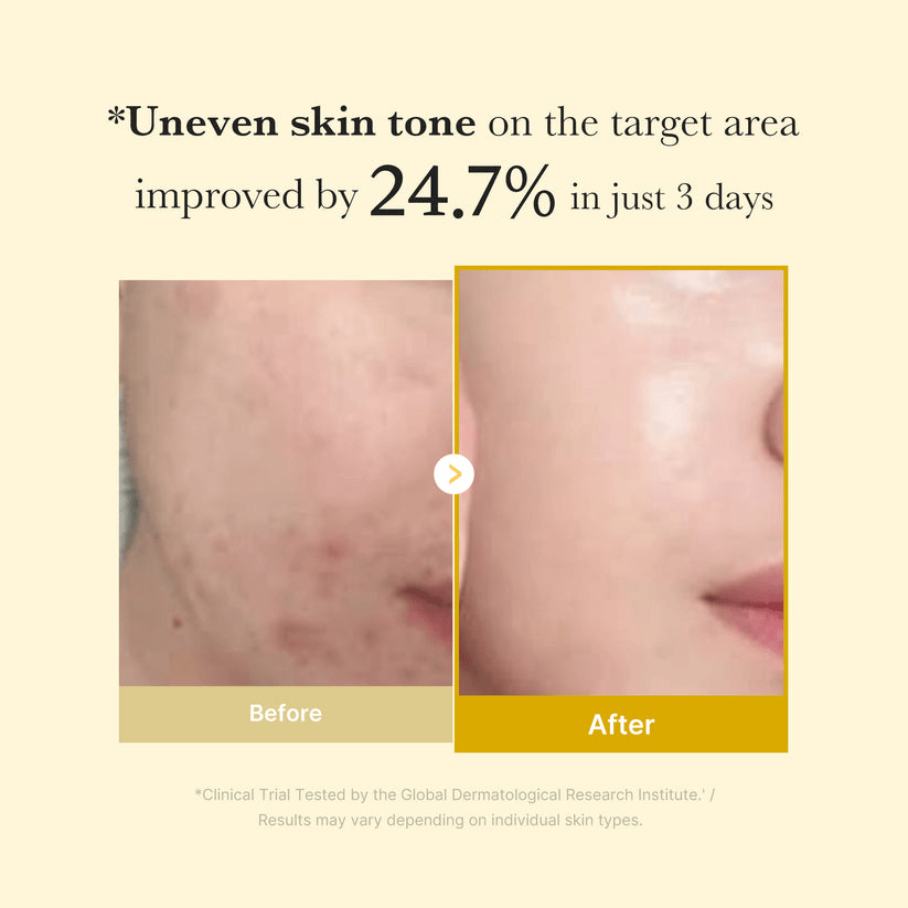 Before and after results of using Medicube Kojic Acid Turmeric Overnight Wrapping Mask, showing improved skin tone.