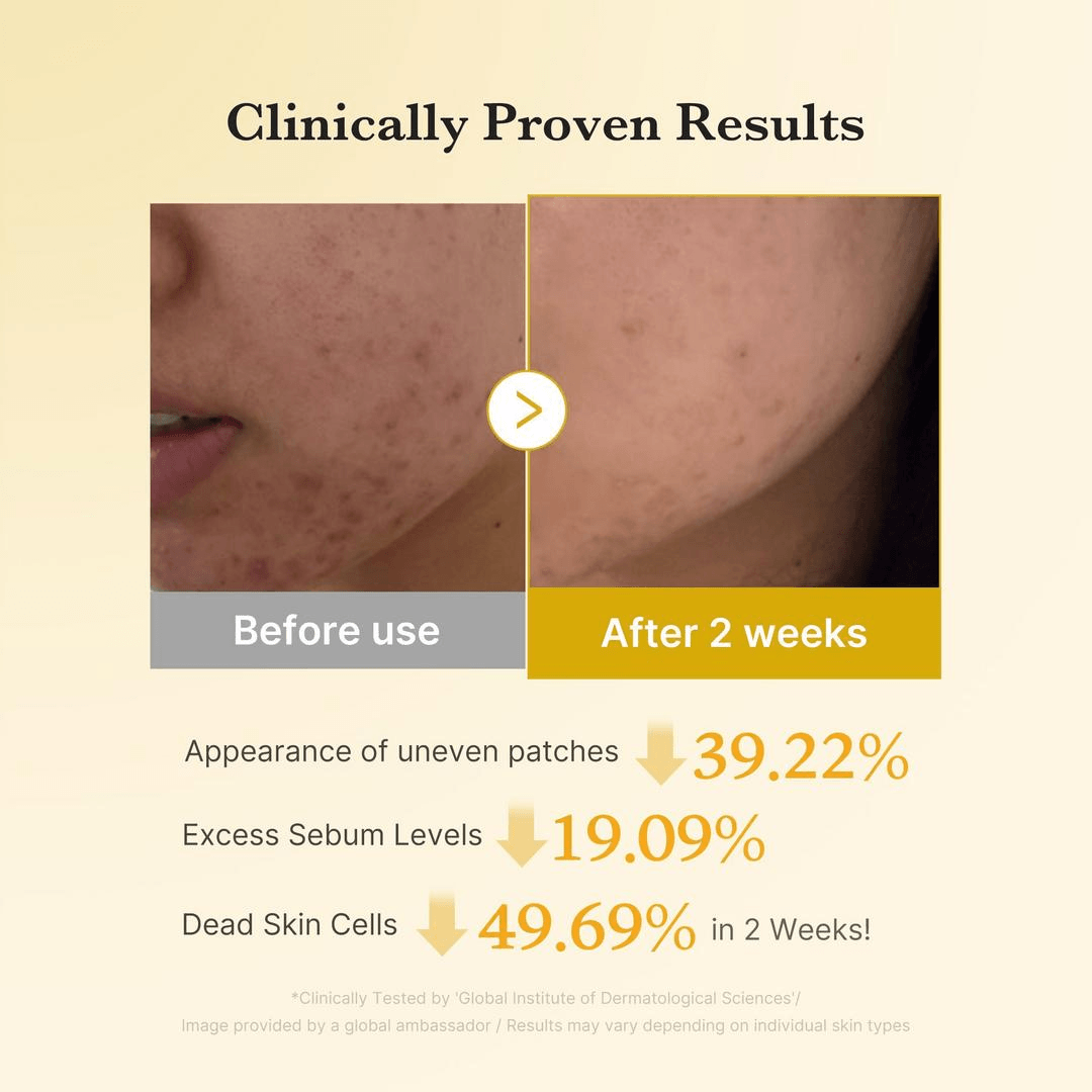 Before and after results showing improvement in skin tone using Medicube Kojic Acid Tumeric Toner Pad over 2 weeks.