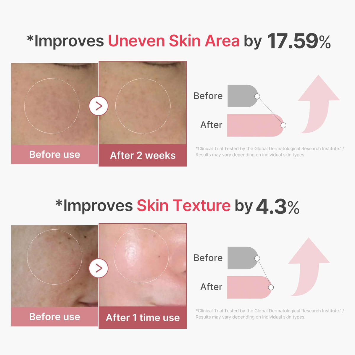 Before and after results showing improvement of uneven skin area and skin texture with Medicube PDRN Pink Collagen Exosome Shot.