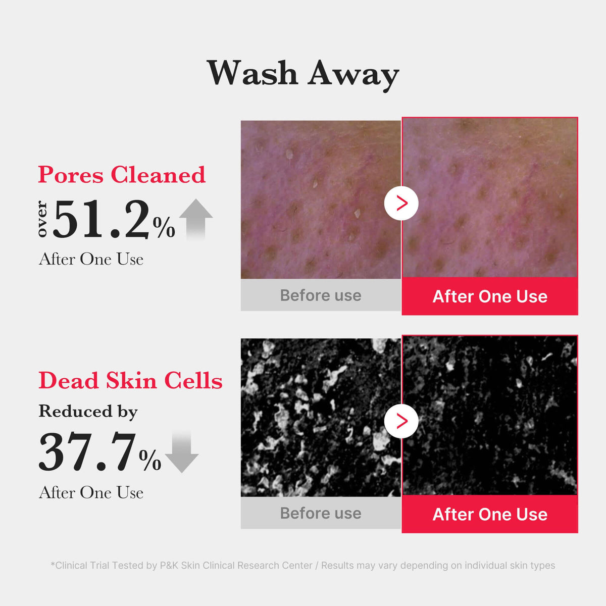 Wash Away results of Medicube Red Foam Cleanser showing 51.2% pores cleaned and 37.7% dead skin cells reduced after one use.