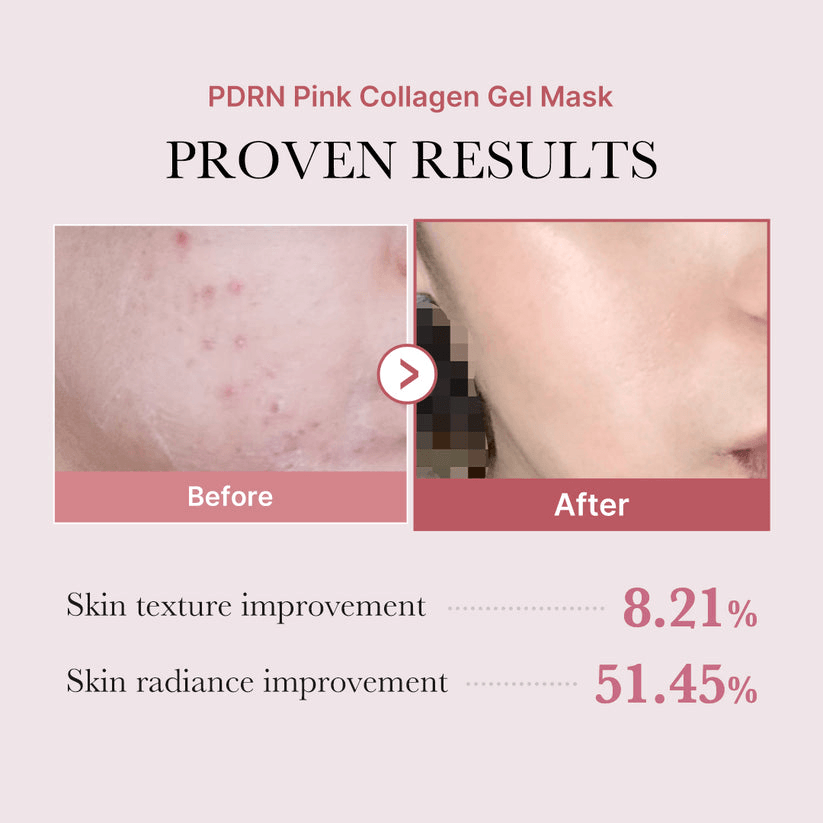 Before and after results of Medicube Salmon PDRN Pink Collagen Jelly Gel Mask showcasing skin improvement.