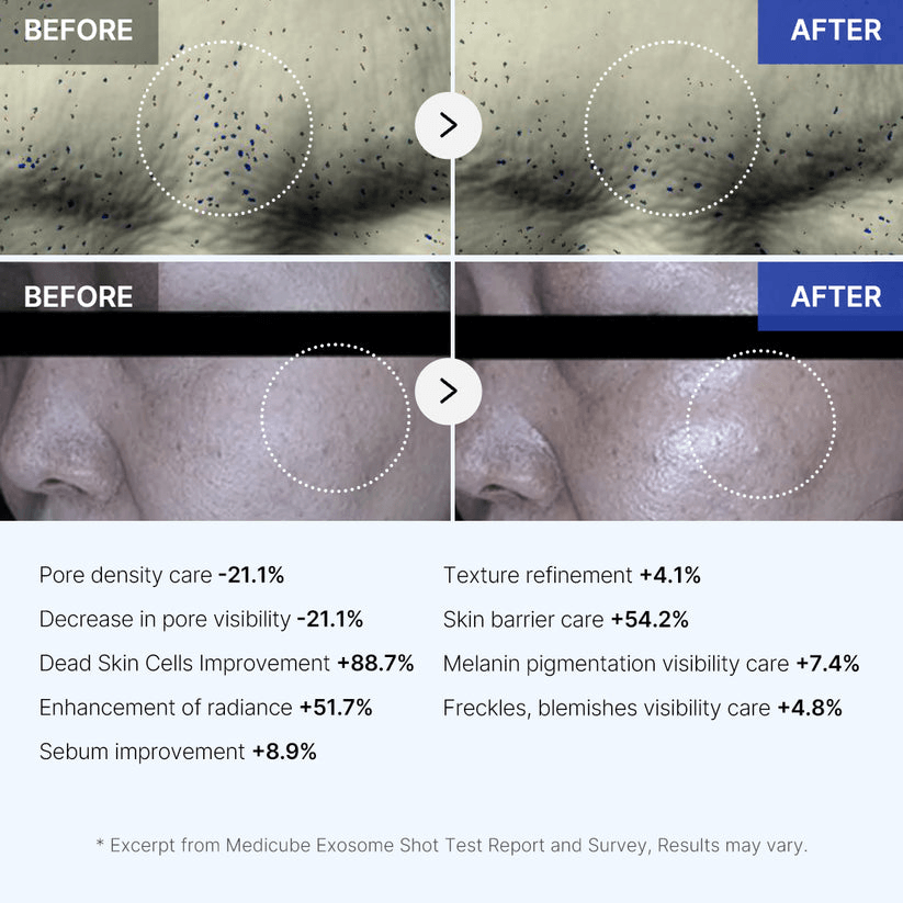 Before and after results of Medicube Zero Exosome Shot showing improvement in skin texture, pore visibility, and radiance.