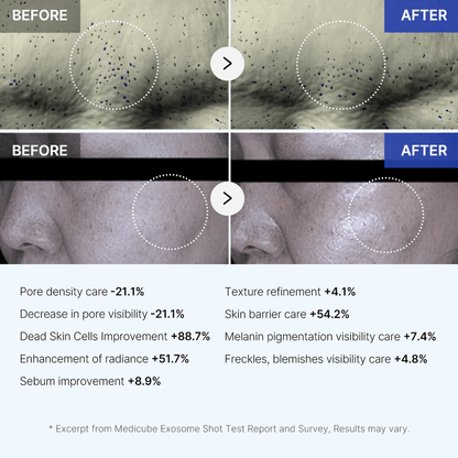 Before and after results of Medicube Zero Exosome Shot showing improvement in skin texture, pore visibility, and radiance.