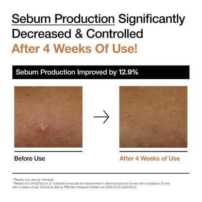 Anua Rice 70 Glow Milky Toner Image showing sebum production significantly decreased and controlled after 4 weeks of use, with results improved by 12.9%.
